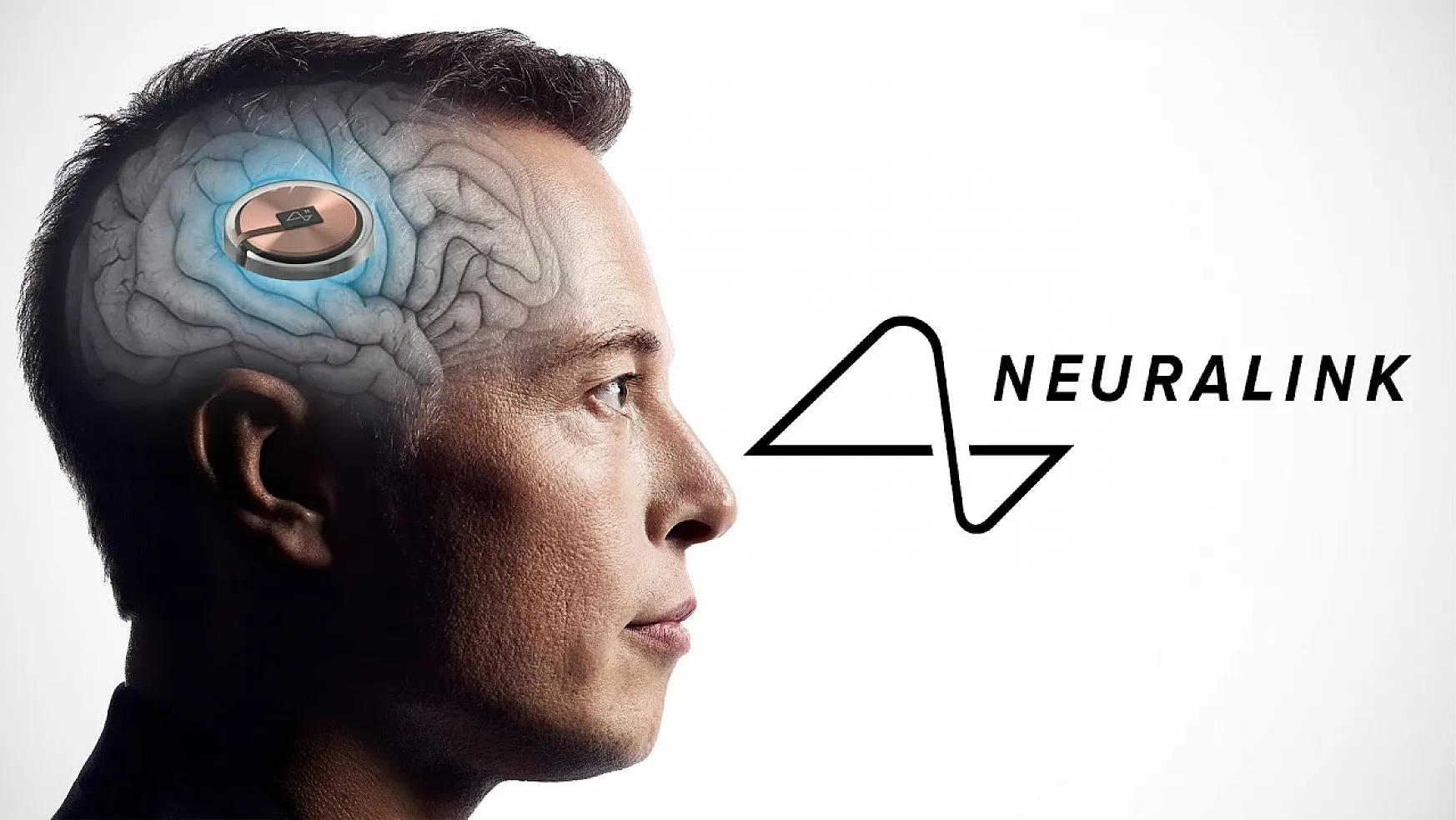 Elon Musk'ın şirketi Neuralink ilk kez bir insanın beynine çip yerleştirdi